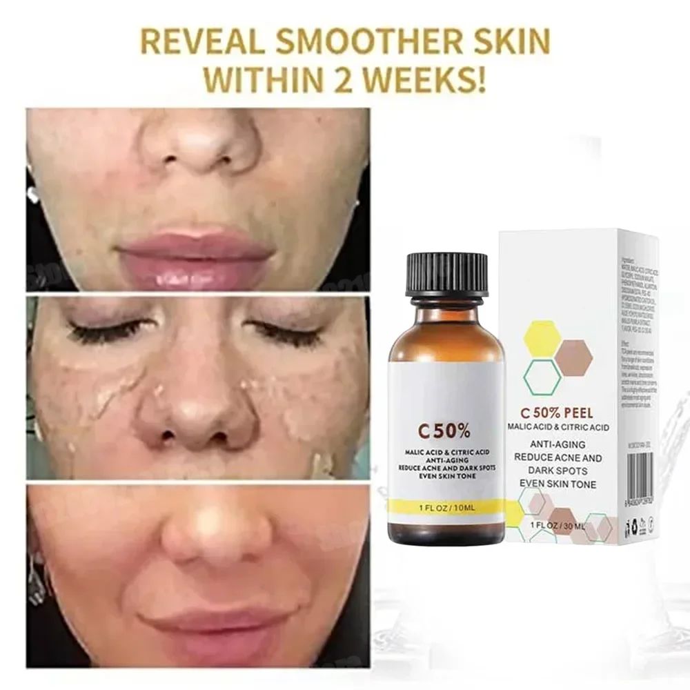 Skincare Salicylic Acid - 살리실산 페이스 페이셜 필 중화제 페이스