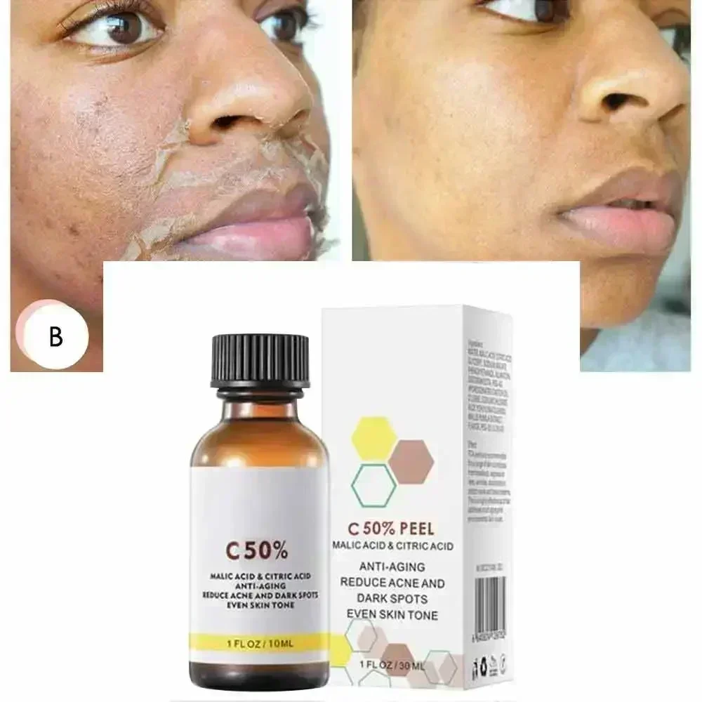 살리실산 페이스 페이셜 필 중화제 페이스 딥 홈 케미컬 - Skincare Salicylic Acid 리뷰 및 가격