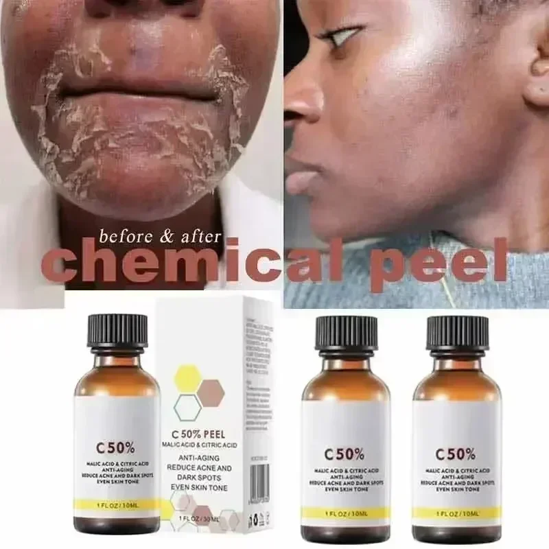 살리실산 페이스 페이셜 필 중화제 페이스 딥 홈 케미컬 - Skincare Salicylic Acid 리뷰 및 가격