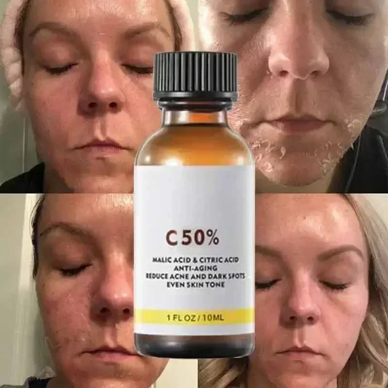 살리실산 페이스 페이셜 필 중화제 페이스 딥 홈 케미컬 - Skincare Salicylic Acid 리뷰 및 가격