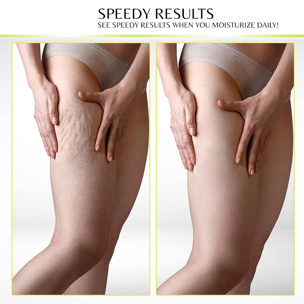 콜라겐 레티놀 콜라겐 페이스 크림 수분 공급 히알루론산 - Retinol Vitamin A Cream 리뷰 및 가격