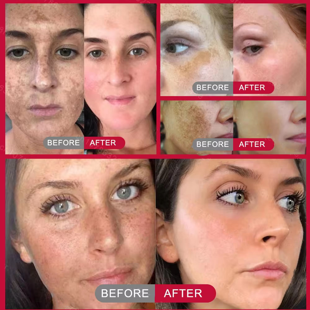 강력한 잡티 제거 미백 크림, 피부를 빠르게 밝게 해주 - Skincare Vitamin C 리뷰 및 가격